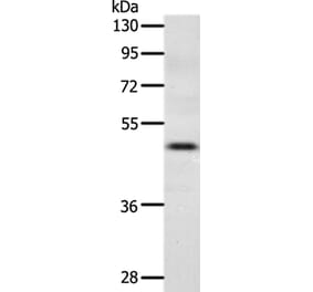 CCR3 Antibody from Signalway Antibody (36785) - Antibodies.com