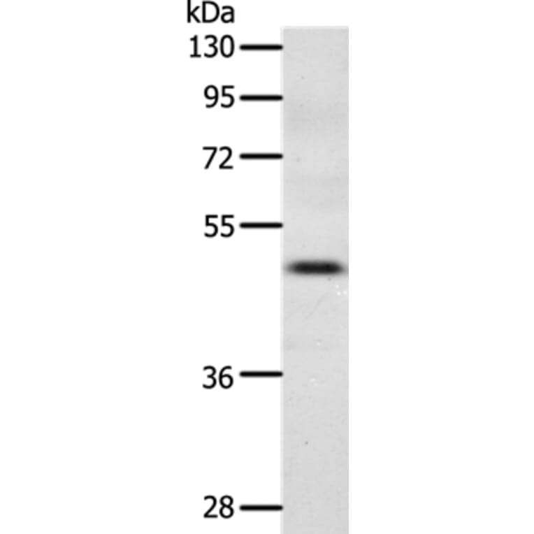 CCR3 Antibody from Signalway Antibody (36785) - Antibodies.com