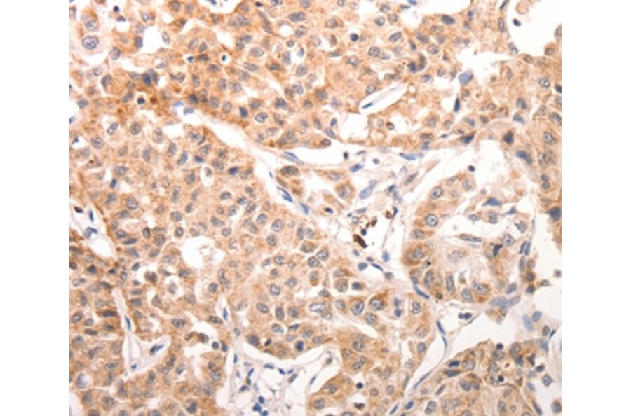 Immunohistochemistry - CCR3 Antibody from Signalway Antibody (36785) - Antibodies.com