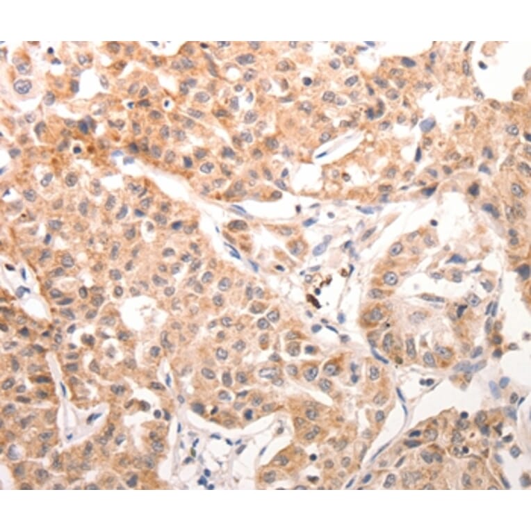 Immunohistochemistry - CCR3 Antibody from Signalway Antibody (36785) - Antibodies.com