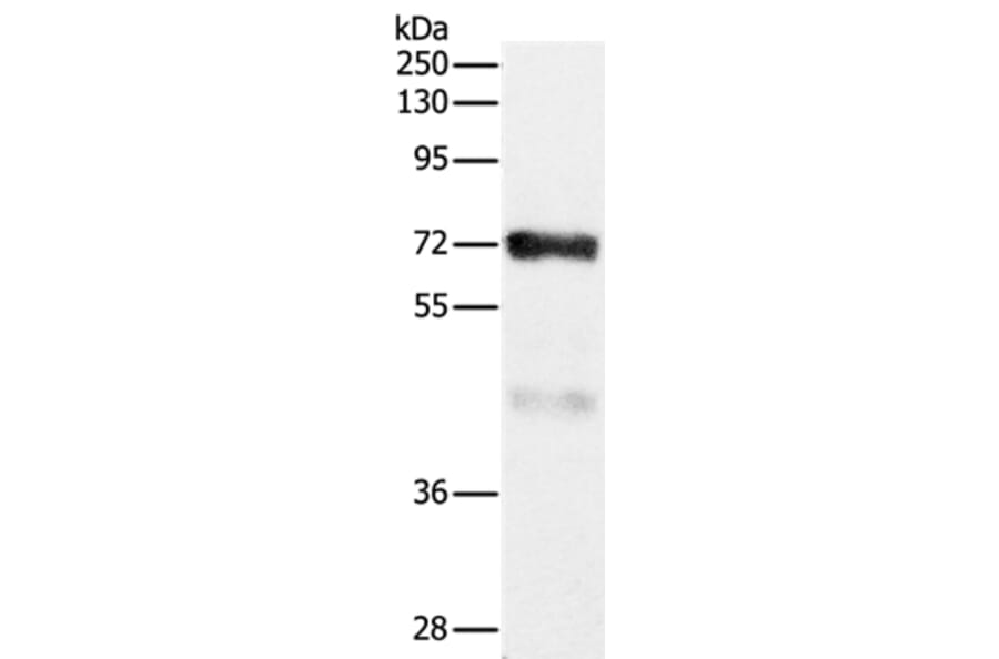 CPT2 Antibody from Signalway Antibody (36802) - Antibodies.com