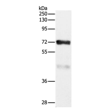 CPT2 Antibody from Signalway Antibody (36802) - Antibodies.com
