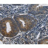 Immunohistochemistry - CTGF Antibody from Signalway Antibody (36807) - Antibodies.com