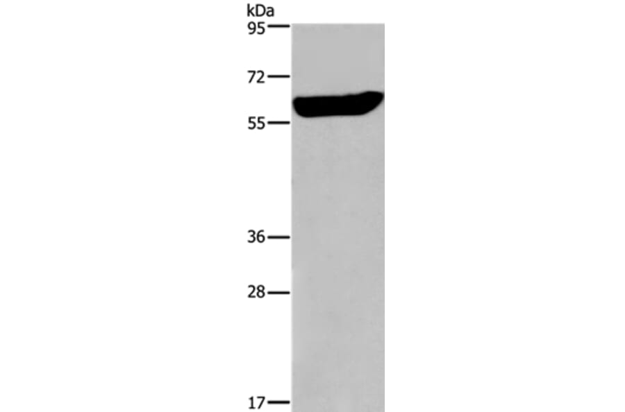 EGR4 Antibody from Signalway Antibody (36837) - Antibodies.com