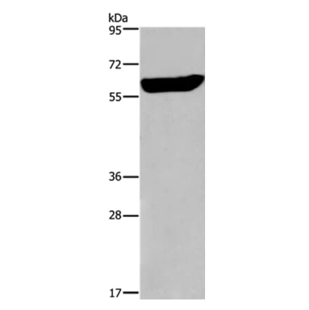EGR4 Antibody from Signalway Antibody (36837) - Antibodies.com