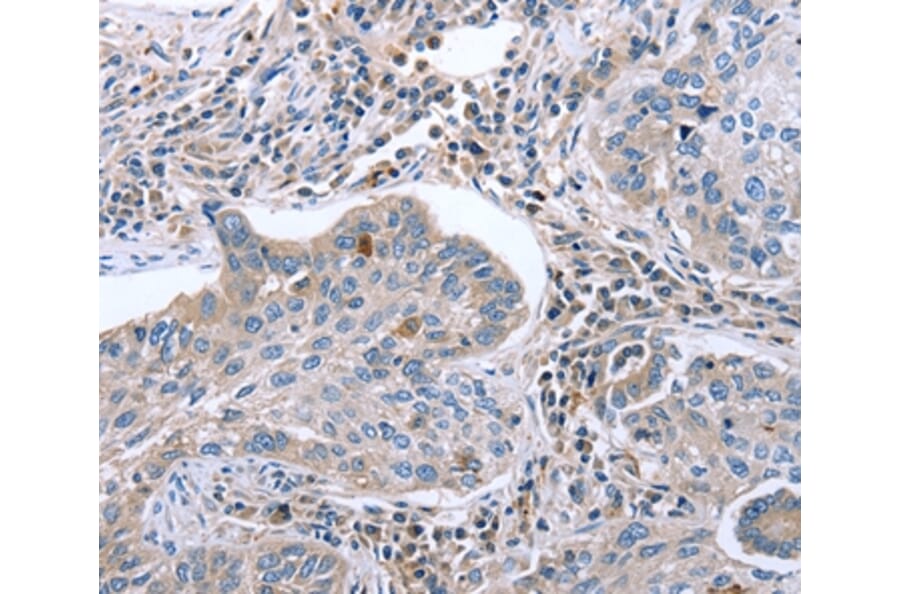 Immunohistochemistry - EGR4 Antibody from Signalway Antibody (36837) - Antibodies.com