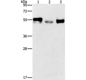 FOSB Antibody from Signalway Antibody (36855) - Antibodies.com