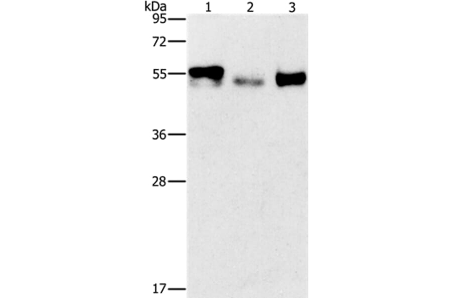 FOSB Antibody from Signalway Antibody (36855) - Antibodies.com