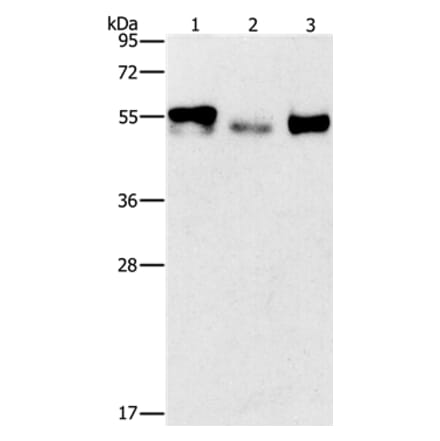 FOSB Antibody from Signalway Antibody (36855) - Antibodies.com