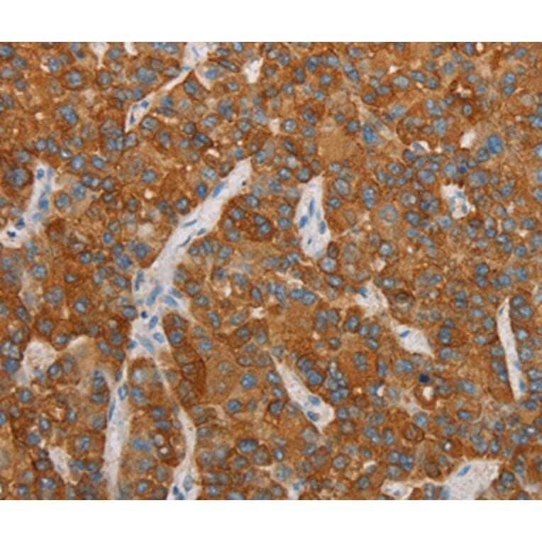 Immunohistochemistry - FOSB Antibody from Signalway Antibody (36855) - Antibodies.com