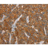 Immunohistochemistry - FOSB Antibody from Signalway Antibody (36855) - Antibodies.com