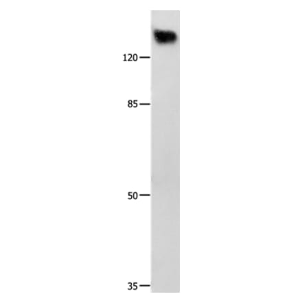 GRM1 Antibody from Signalway Antibody (36913) - Antibodies.com