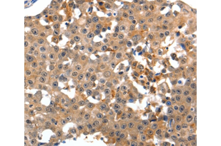 Immunohistochemistry - GRM1 Antibody from Signalway Antibody (36913) - Antibodies.com