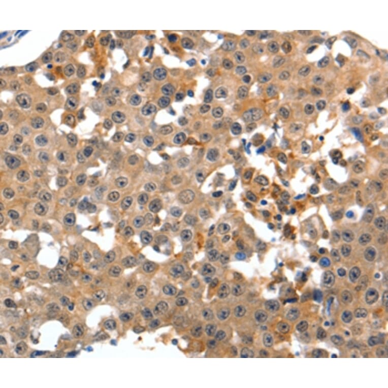 Immunohistochemistry - GRM1 Antibody from Signalway Antibody (36913) - Antibodies.com