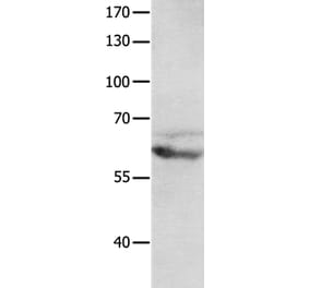 GRM8 Antibody from Signalway Antibody (36914) - Antibodies.com