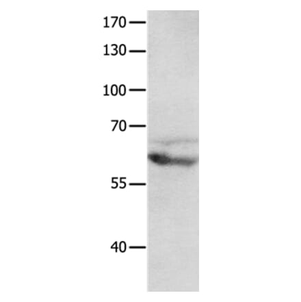 GRM8 Antibody from Signalway Antibody (36914) - Antibodies.com