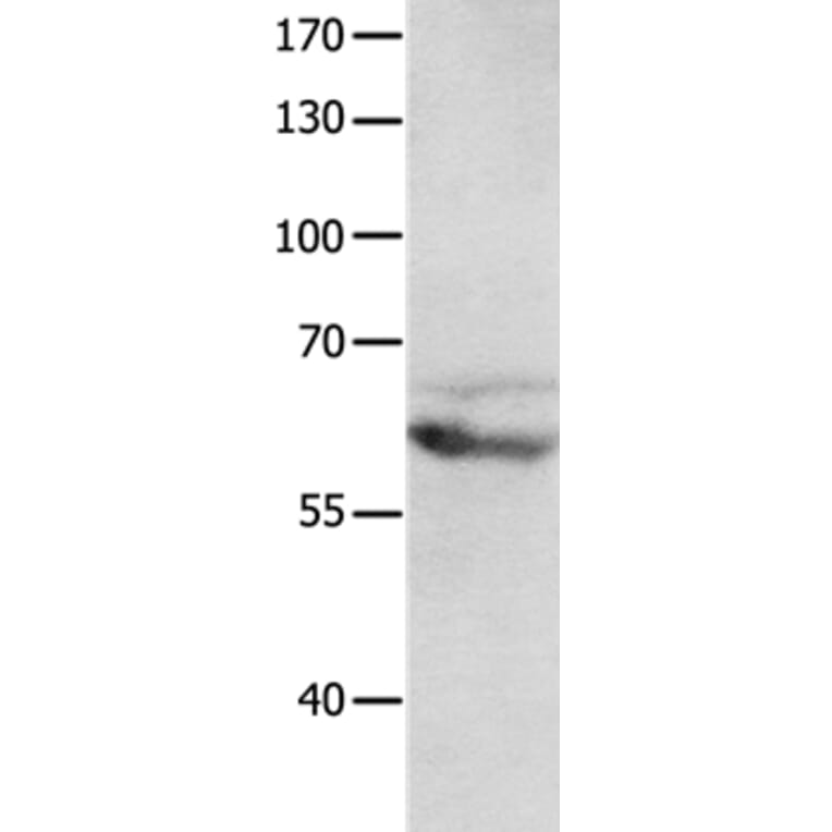 GRM8 Antibody from Signalway Antibody (36914) - Antibodies.com