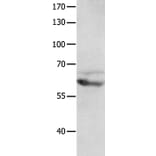 GRM8 Antibody from Signalway Antibody (36914) - Antibodies.com