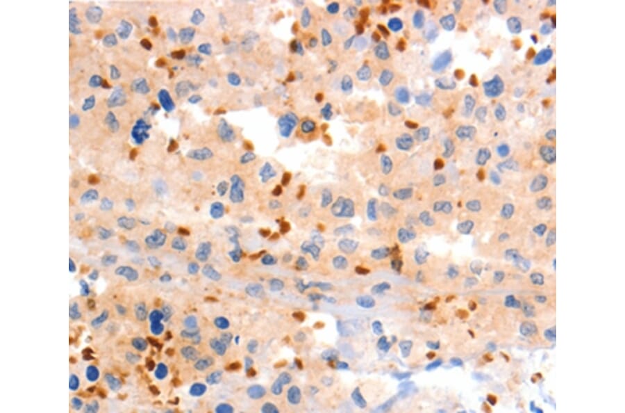 Immunohistochemistry - GRM8 Antibody from Signalway Antibody (36914) - Antibodies.com