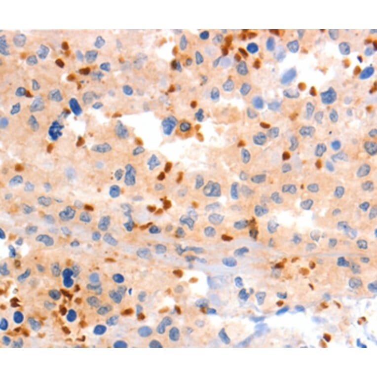 Immunohistochemistry - GRM8 Antibody from Signalway Antibody (36914) - Antibodies.com