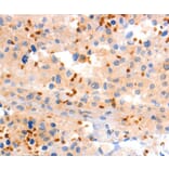 Immunohistochemistry - GRM8 Antibody from Signalway Antibody (36914) - Antibodies.com