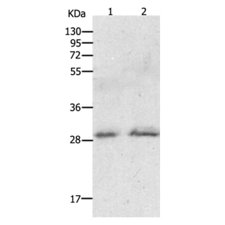 GCH1 Antibody from Signalway Antibody (36919) - Antibodies.com