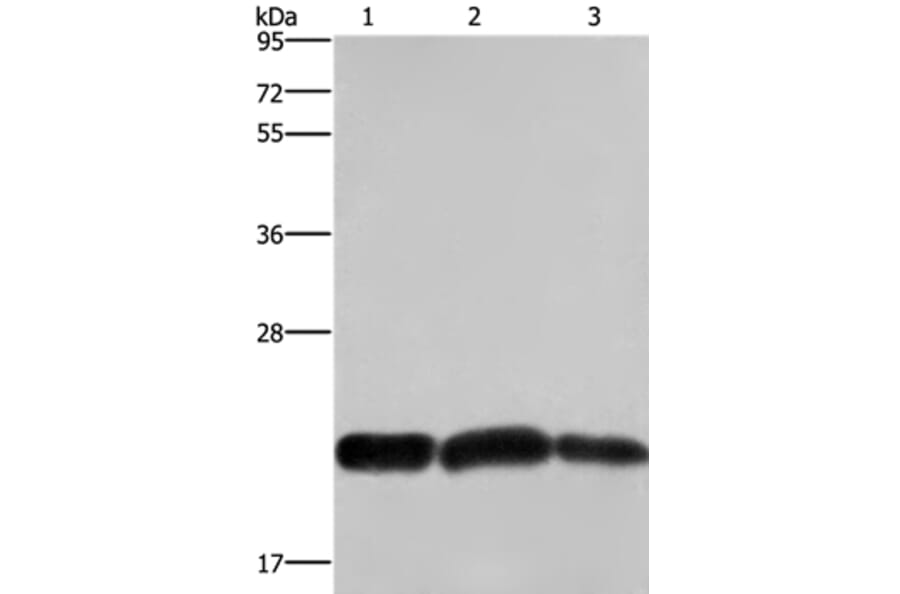 CBX3 Antibody from Signalway Antibody (36926) - Antibodies.com