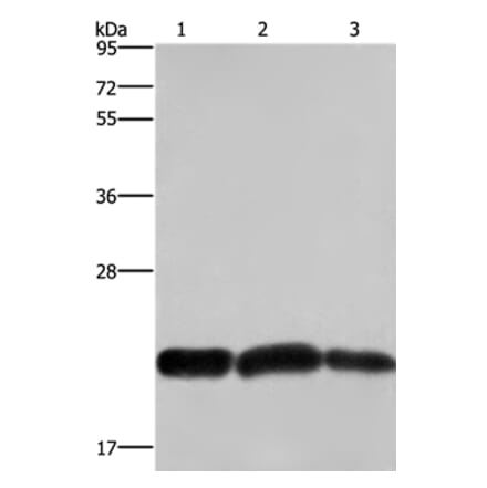CBX3 Antibody from Signalway Antibody (36926) - Antibodies.com
