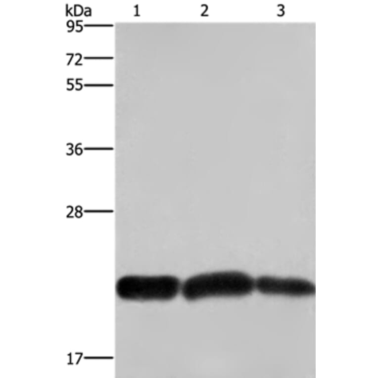 CBX3 Antibody from Signalway Antibody (36926) - Antibodies.com