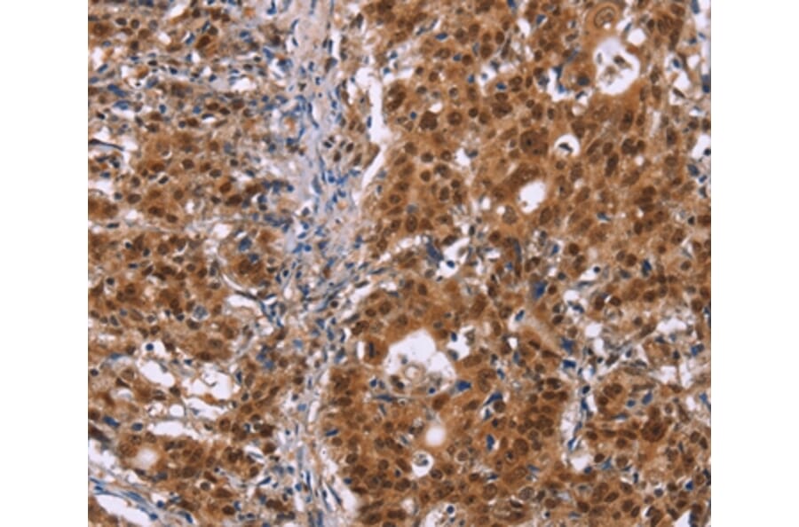 Immunohistochemistry - CBX3 Antibody from Signalway Antibody (36926) - Antibodies.com