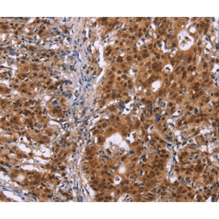 Immunohistochemistry - CBX3 Antibody from Signalway Antibody (36926) - Antibodies.com