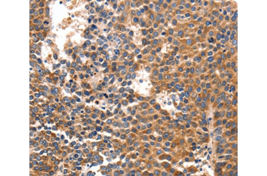 Immunohistochemistry - IRF1 Antibody from Signalway Antibody (36934) - Antibodies.com