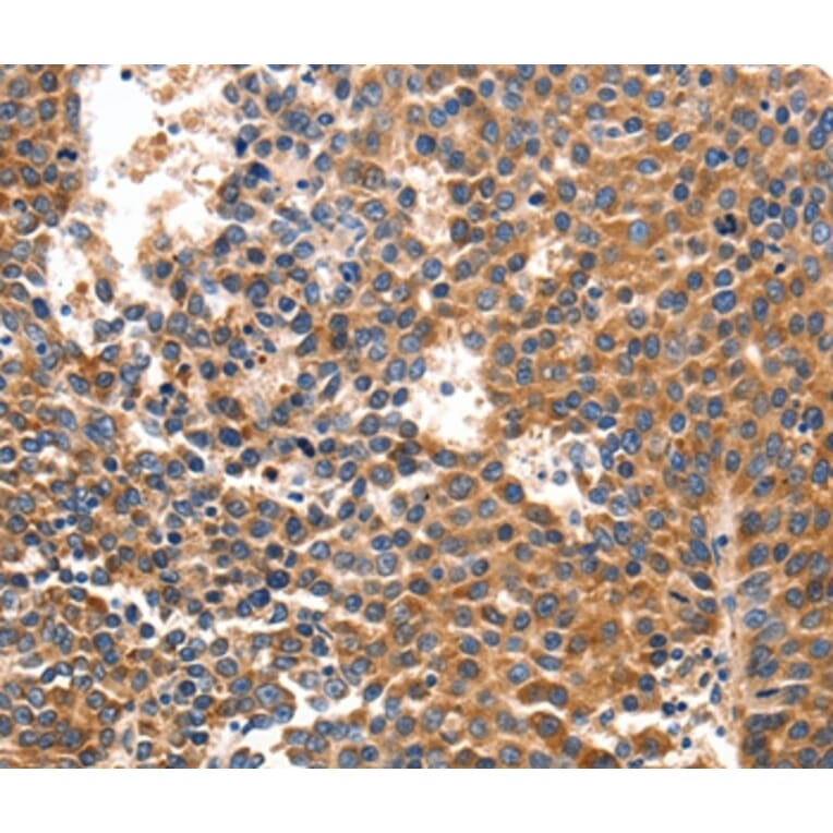 Immunohistochemistry - IRF1 Antibody from Signalway Antibody (36934) - Antibodies.com