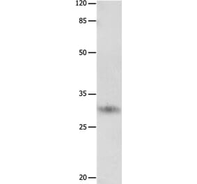 KLK2 Antibody from Signalway Antibody (36940) - Antibodies.com