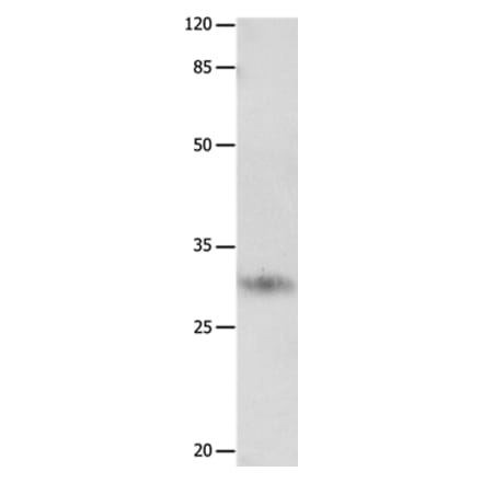 KLK2 Antibody from Signalway Antibody (36940) - Antibodies.com