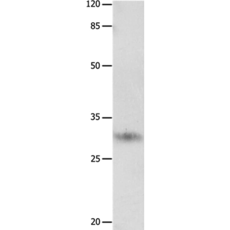 KLK2 Antibody from Signalway Antibody (36940) - Antibodies.com