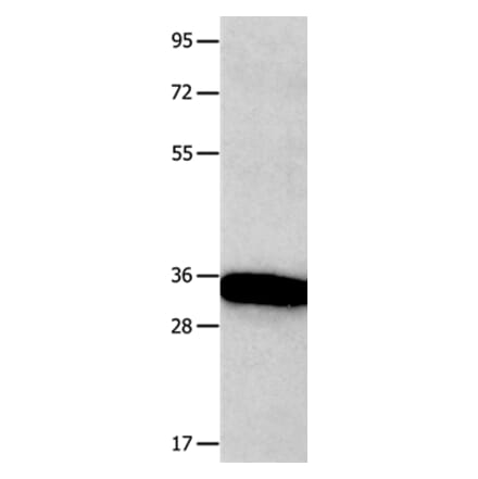 KLK5 Antibody from Signalway Antibody (36941) - Antibodies.com