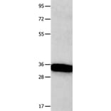 KLK5 Antibody from Signalway Antibody (36941) - Antibodies.com