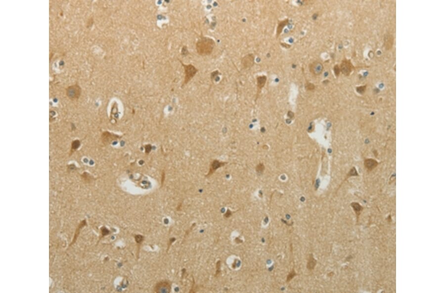 Immunohistochemistry - MCM4 Antibody from Signalway Antibody (36977) - Antibodies.com