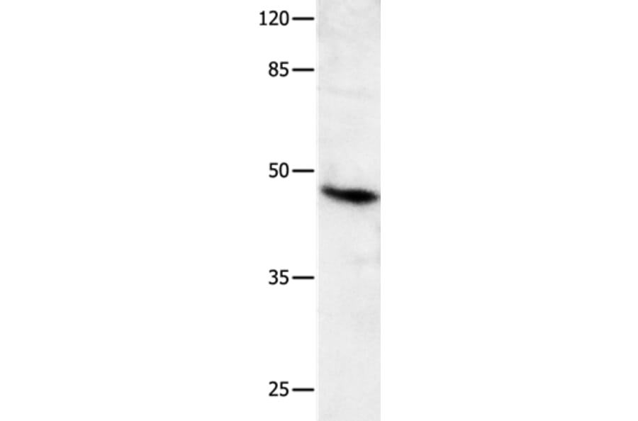 MLNR Antibody from Signalway Antibody (36990) - Antibodies.com