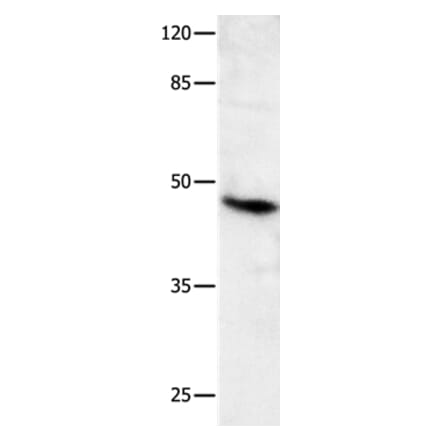 MLNR Antibody from Signalway Antibody (36990) - Antibodies.com