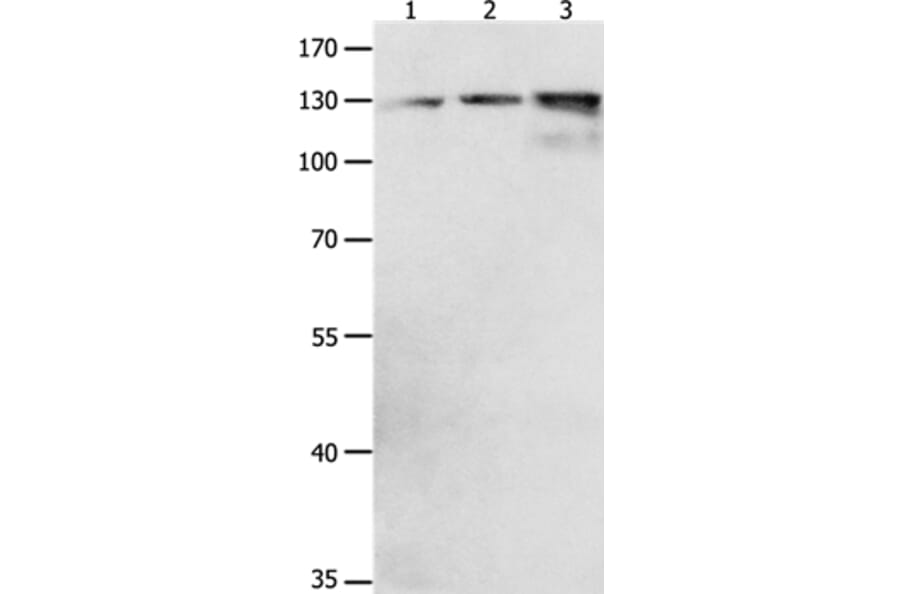 CDH1 Antibody from Signalway Antibody (36994) - Antibodies.com
