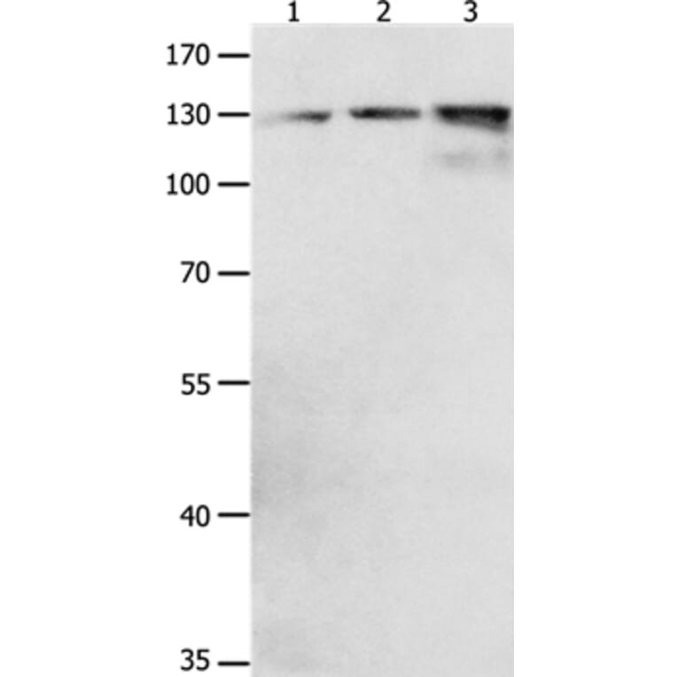 CDH1 Antibody from Signalway Antibody (36994) - Antibodies.com