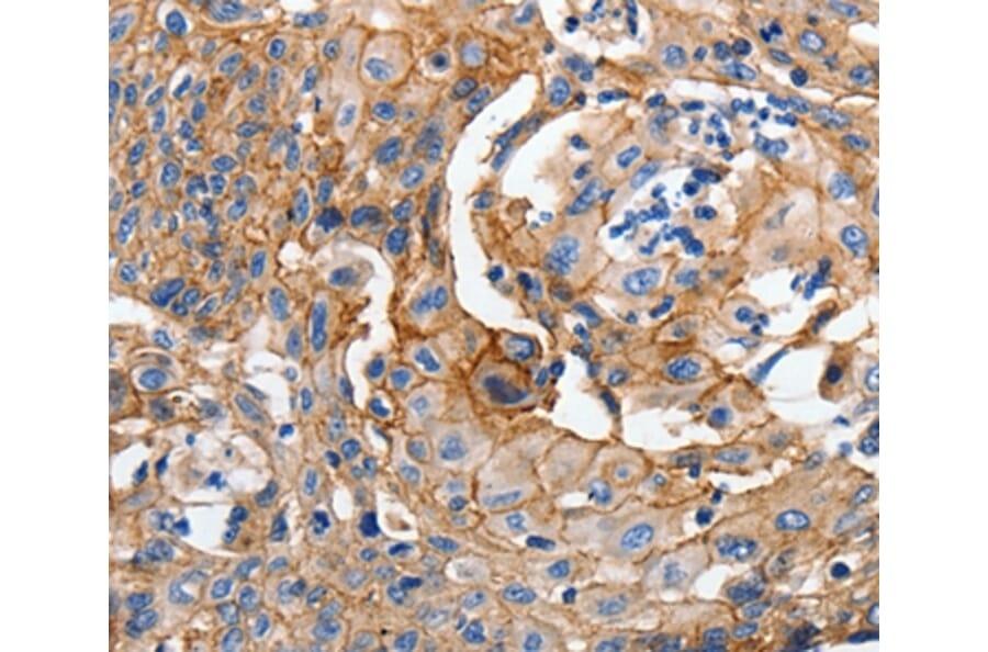 Immunohistochemistry - CDH1 Antibody from Signalway Antibody (36994) - Antibodies.com