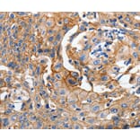 Immunohistochemistry - CDH1 Antibody from Signalway Antibody (36994) - Antibodies.com