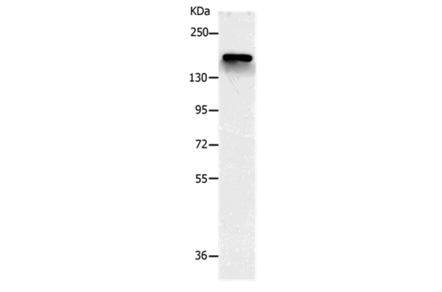 NCAN Antibody from Signalway Antibody (36999) - Antibodies.com