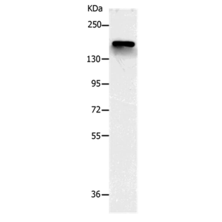NCAN Antibody from Signalway Antibody (36999) - Antibodies.com