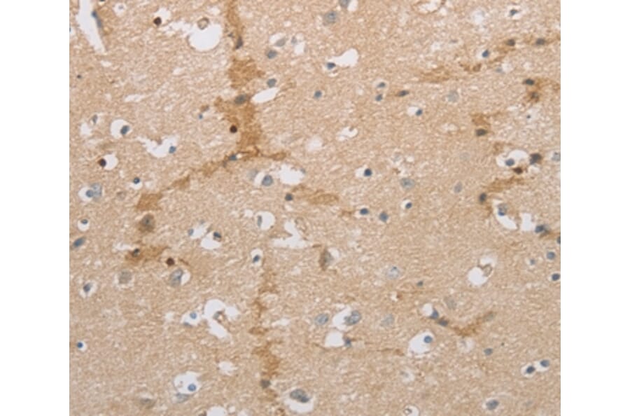 Immunohistochemistry - NCAN Antibody from Signalway Antibody (36999) - Antibodies.com