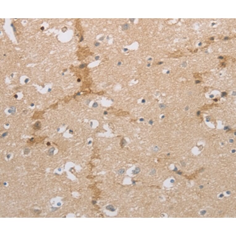 Immunohistochemistry - NCAN Antibody from Signalway Antibody (36999) - Antibodies.com