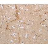 Immunohistochemistry - NCAN Antibody from Signalway Antibody (36999) - Antibodies.com